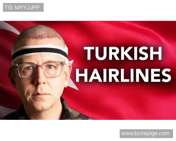 土耳其植发技术助力足球明星重塑自信与风采